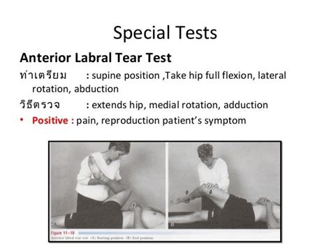 anterior labral tear test hip sensitivity|labral tear special tests hip.